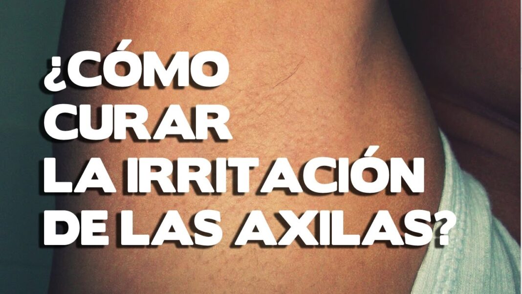 me-pican-las-axilas-remedios-caseros