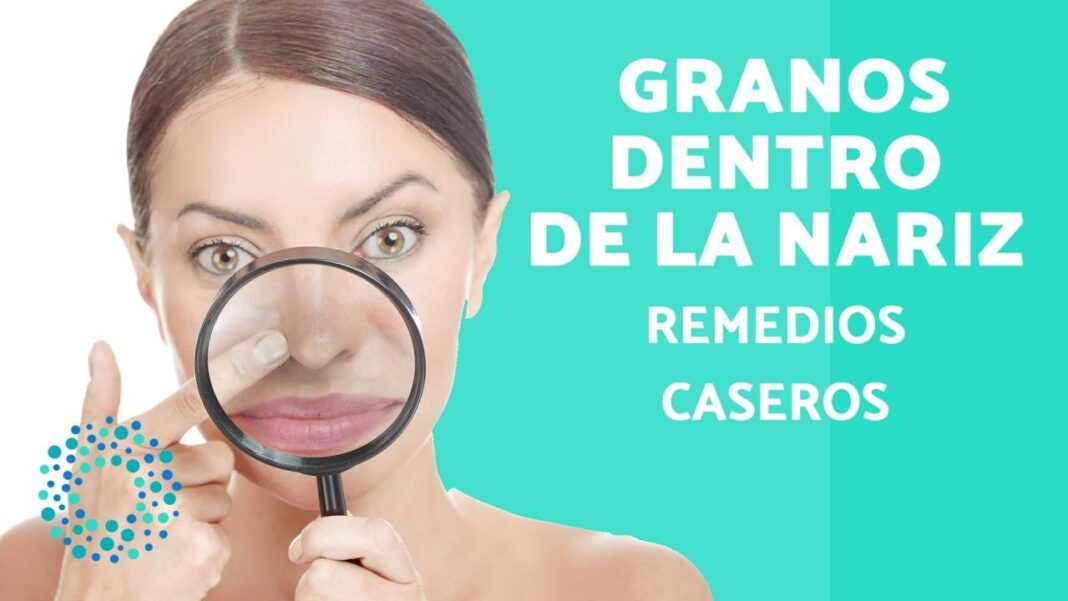remedios-caseros-para-las-heridas-dentro-de-la-nariz