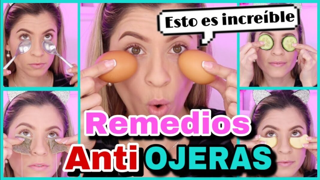 remedios-caseros-para-las-ojeras