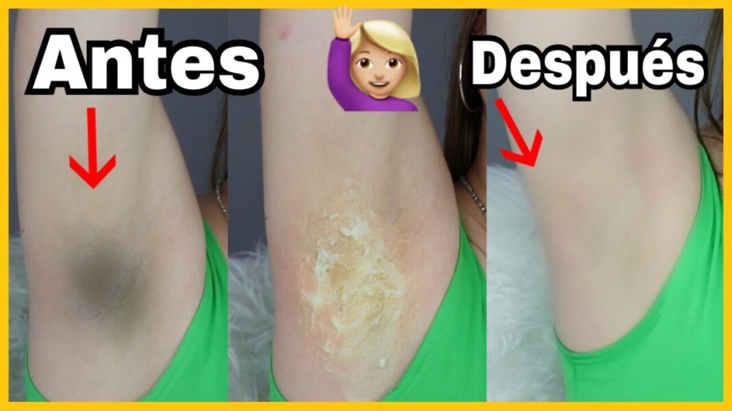como-desmanchar-las-axilas-remedios-caseros