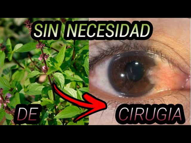 remedio-casero-para-la-carnosidad-en-los-ojos