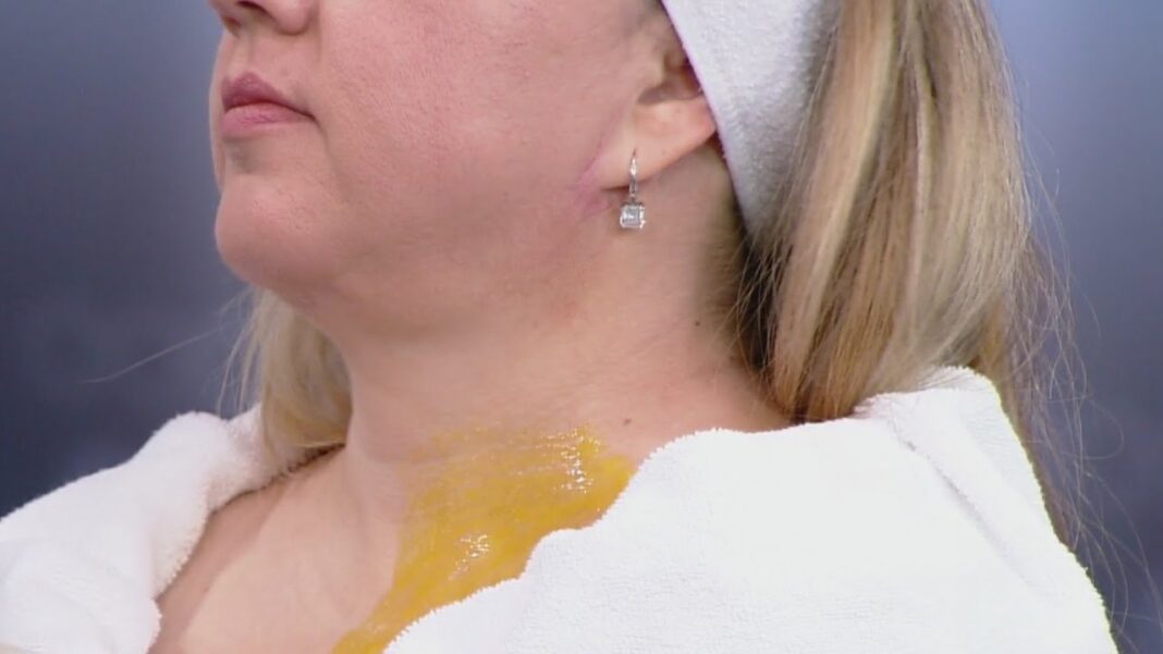 remedio-casero-para-las-arrugas-del-cuello-y-escote