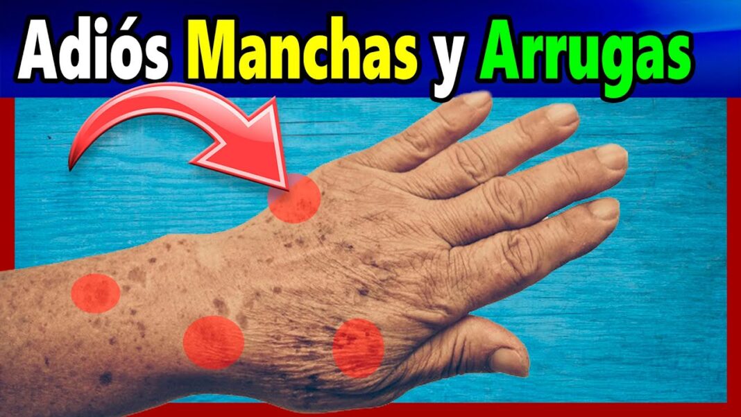 remedio-casero-para-quitar-las-manchas-de-las-manos