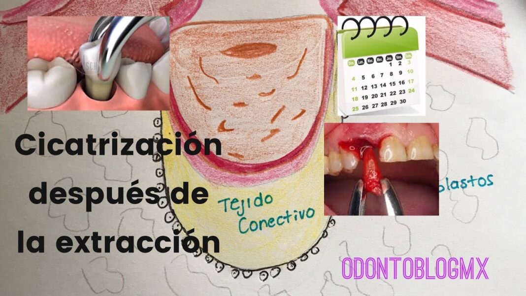 remedios-caseros-para-cicatrizar-encias