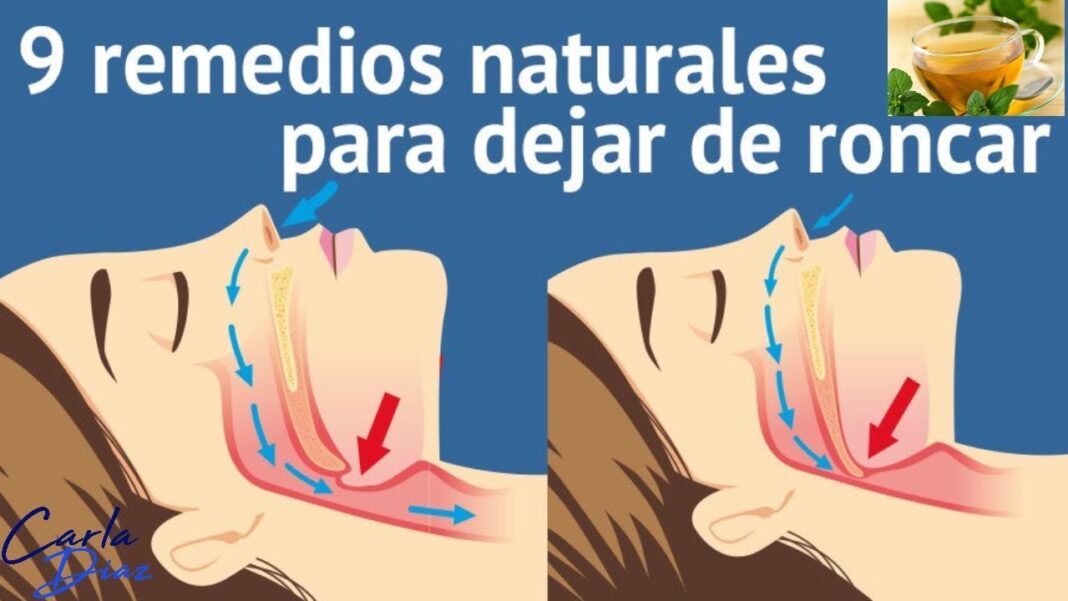 remedios-caseros-para-dejar-de-roncar-hoy-mismo