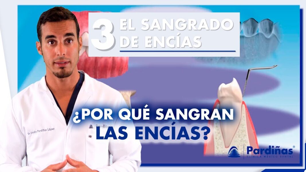 remedios-caseros-para-encias-sangrantes