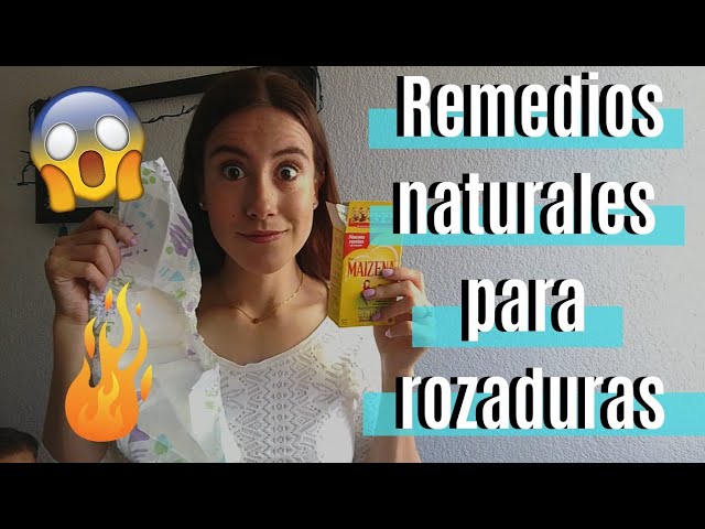 remedios-caseros-para-las-escoceduras-de-bebes