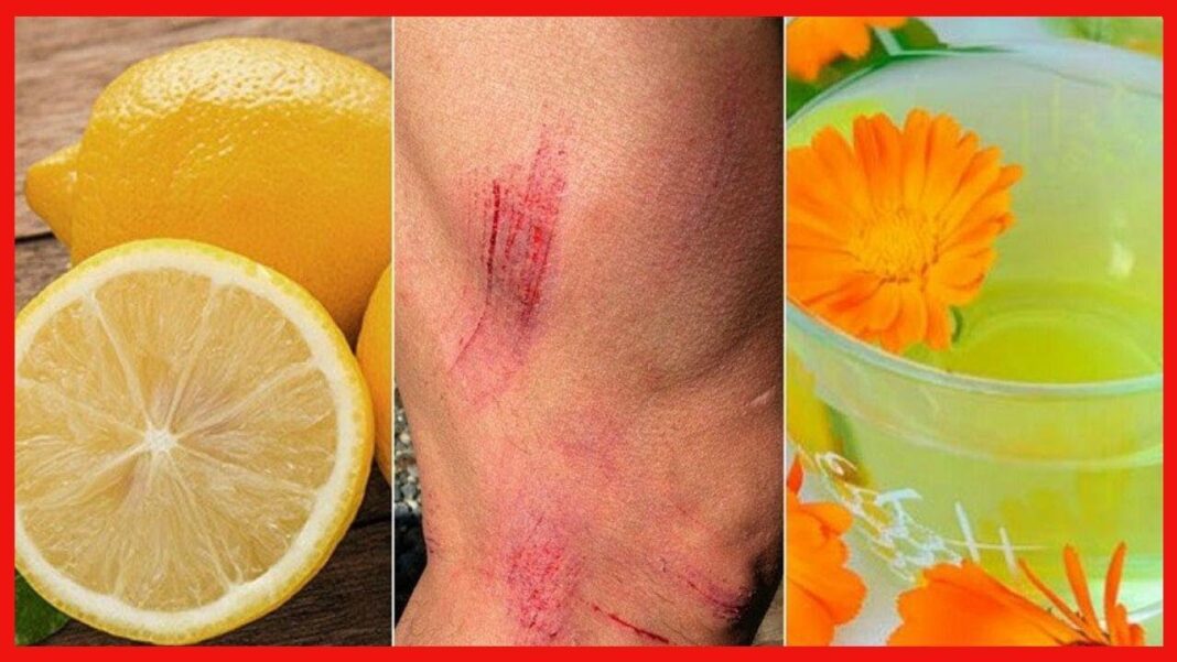 remedios-caseros-para-rasgunos-en-la-cara