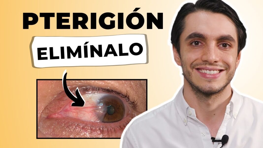 remedio-casero-para-la-carnosidad-en-el-ojo