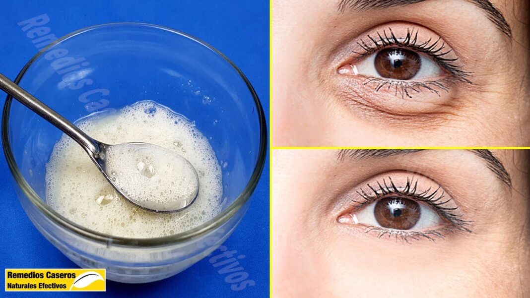 remedios-caseros-para-las-arrugas-de-la-cara-y-ojos