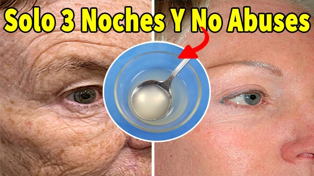 remedios-caseros-para-las-arrugas-dela-cara