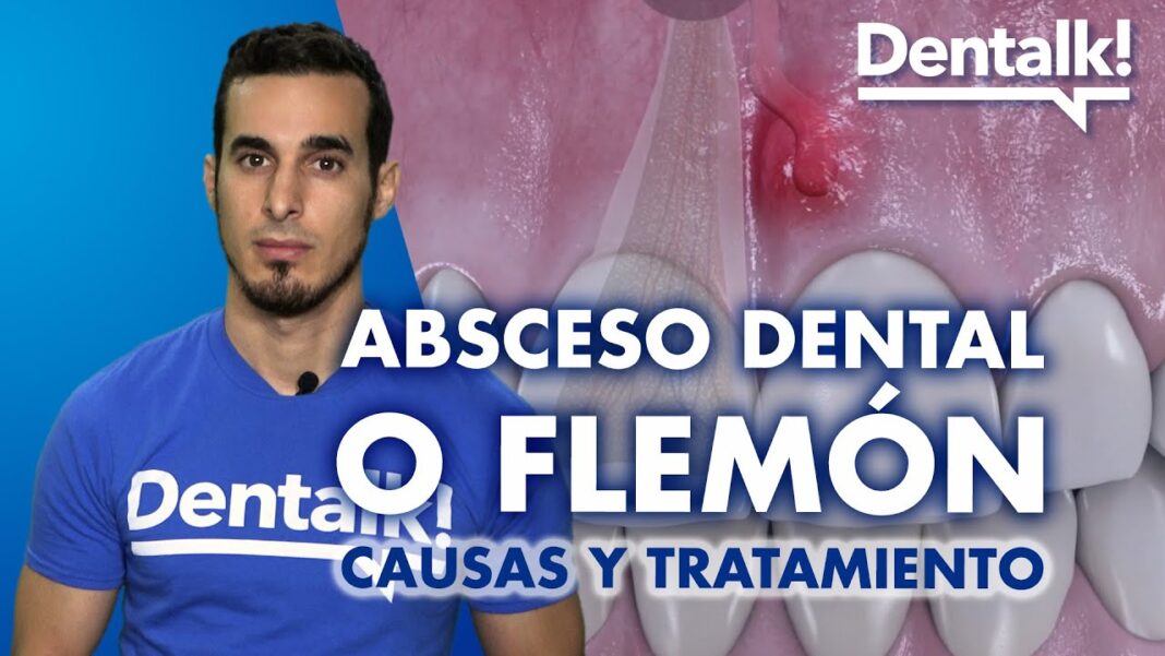 remedios-caseros-para-los-flemones