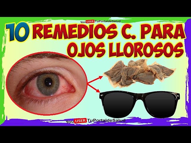 remedios-caseros-para-los-ojos-llorosos