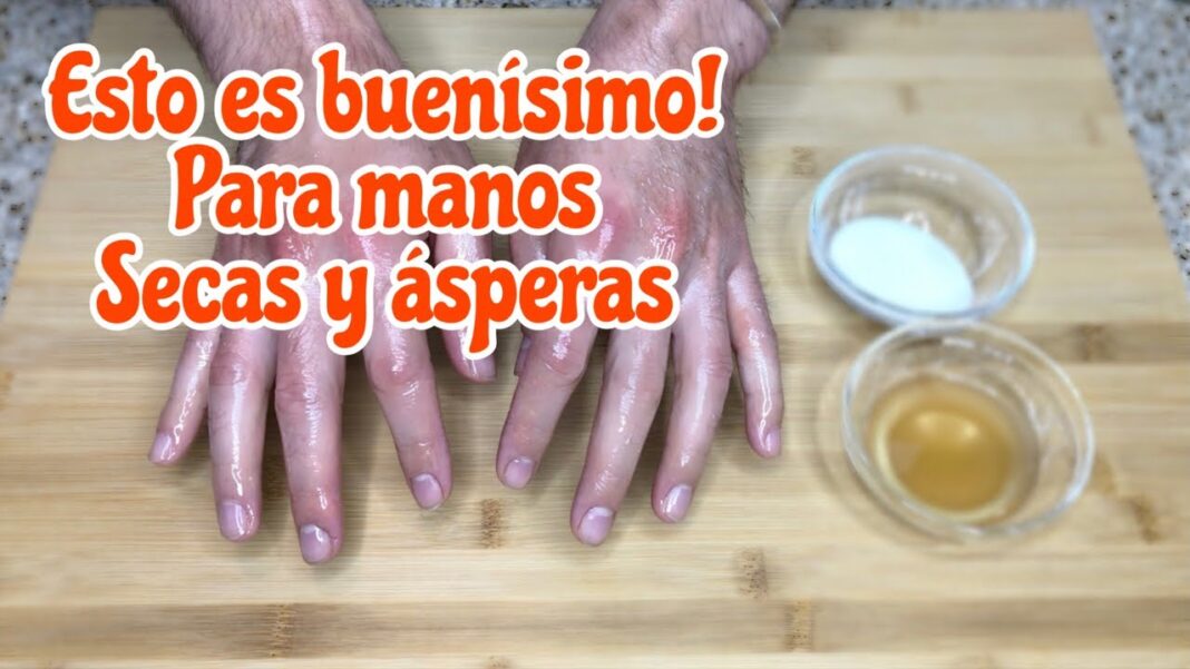 remedios-caseros-para-manos-resecas-y-agrietadas