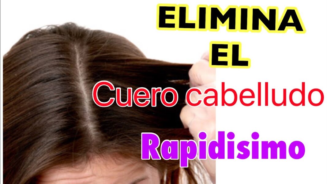 como-eliminar-la-grasa-del-cuero-cabelludo-con-remedios-caseros
