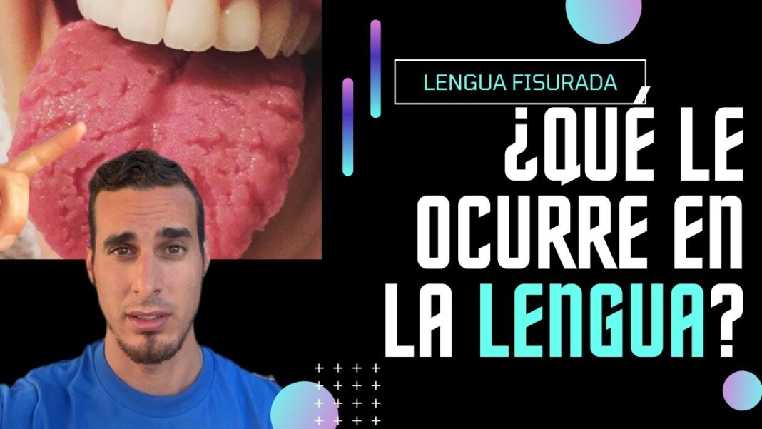 lengua-agrietada-remedios-caseros