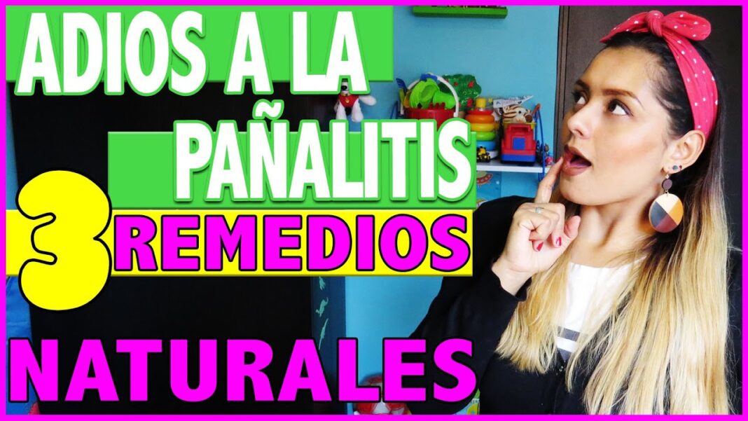 remedios-caseros-para-curar-la-panalitis-en-los-bebes