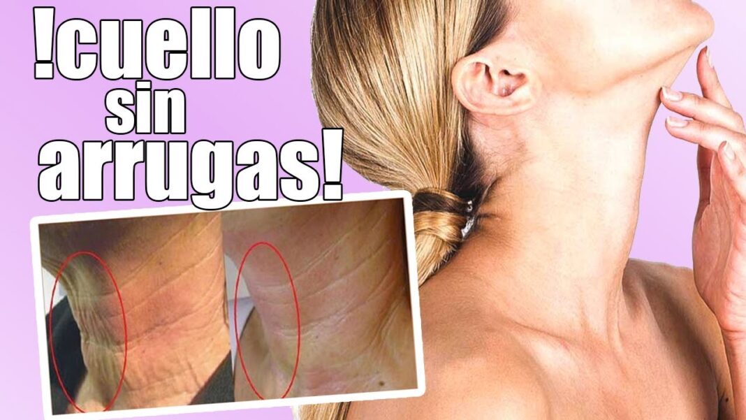remedios-caseros-para-las-arrugas-del-cuello
