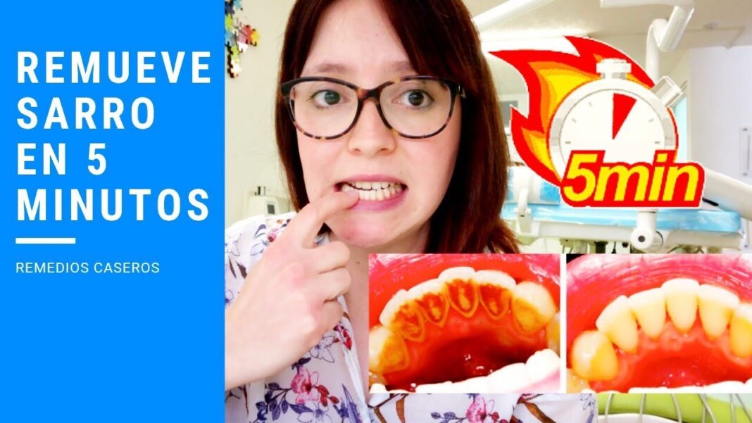 remedios-caseros-para-sarro-en-los-dientes