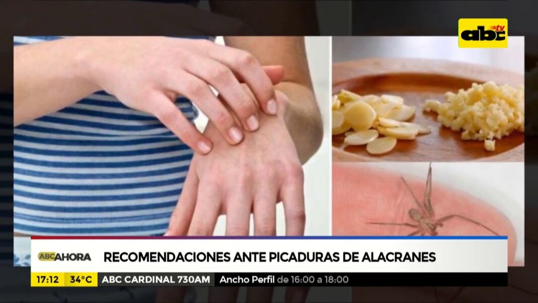 remedios-caseros-para-una-picadura-de-alacran