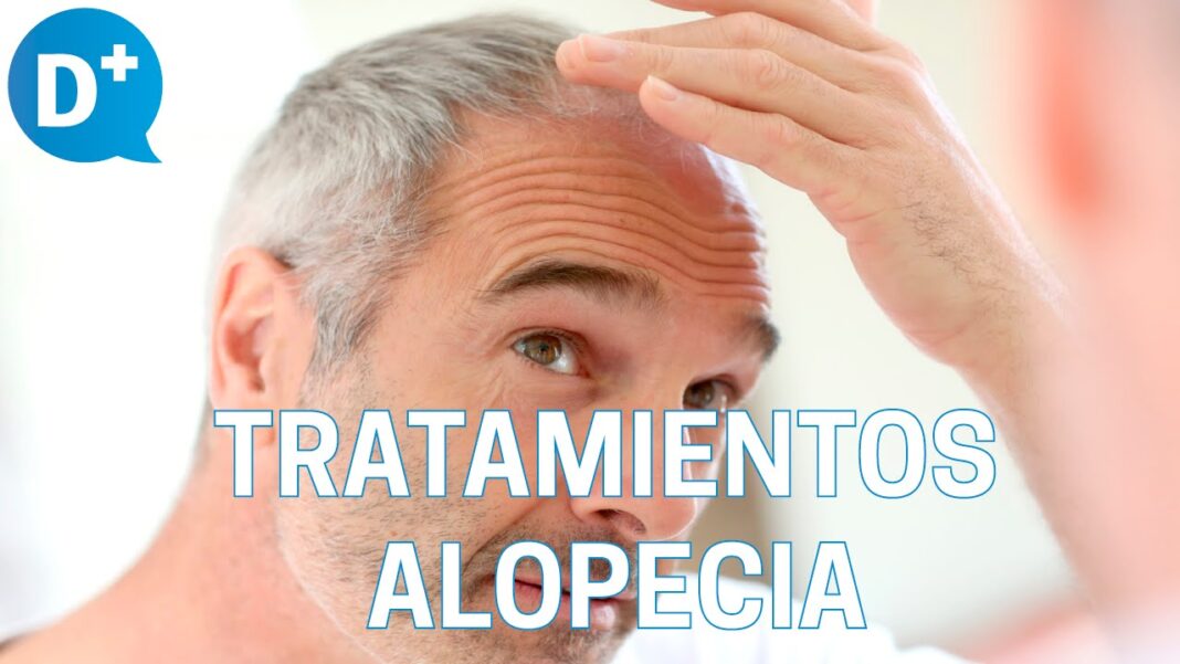Alopecia-areata-remedios-caseros