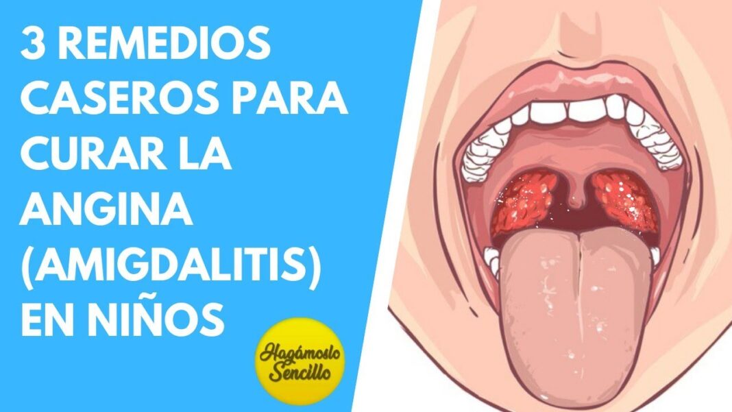 Amigdalas-inflamadas-en-ninos-remedios-caseros