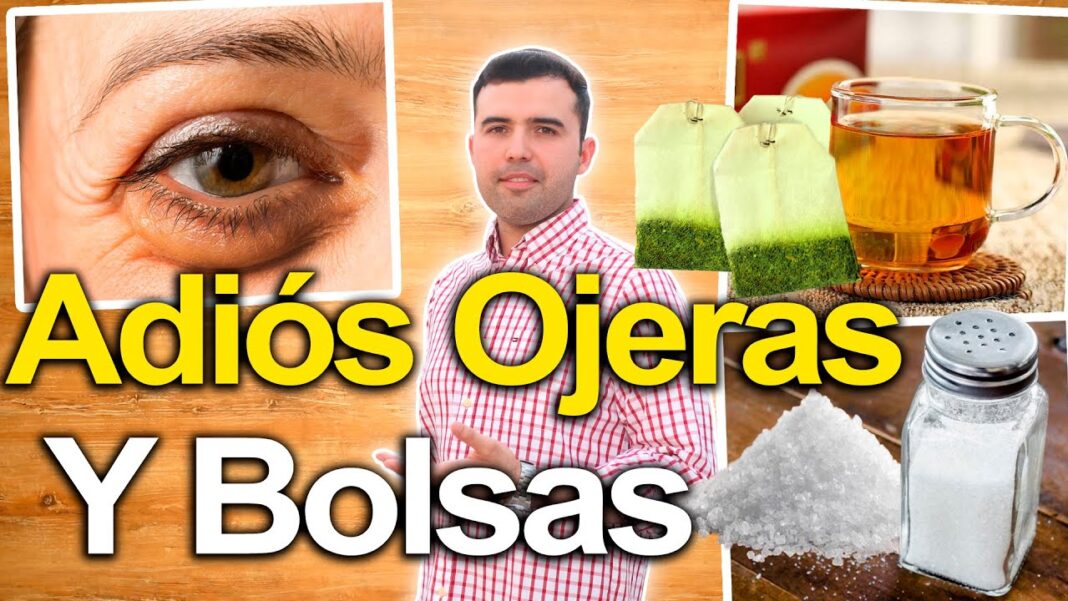 Como-eliminar-las-bolsas-de-los-ojos-remedios-caseros