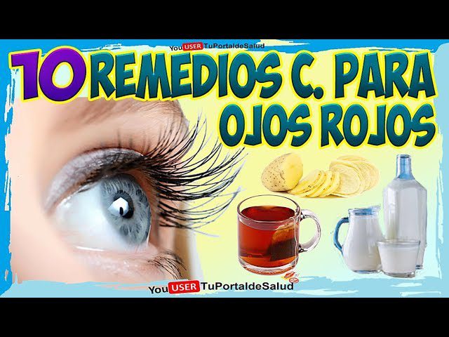 Como-quitar-lo-rojo-de-los-ojos-remedios-caseros