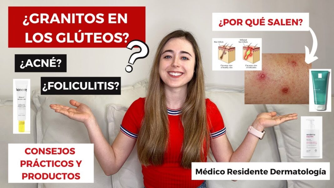 Como-quitar-los-granitos-de-las-pompas-remedios-caseros