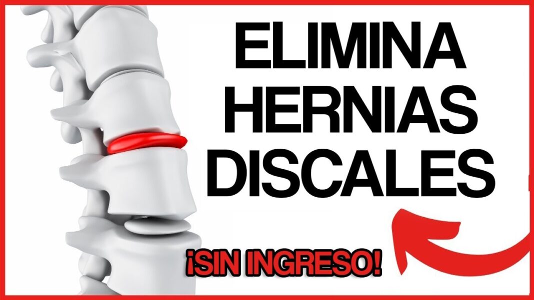 Hernia-remedios-caseros