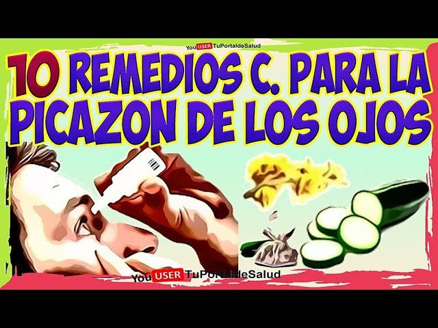Picazon-en-los-ojos-remedios-caseros