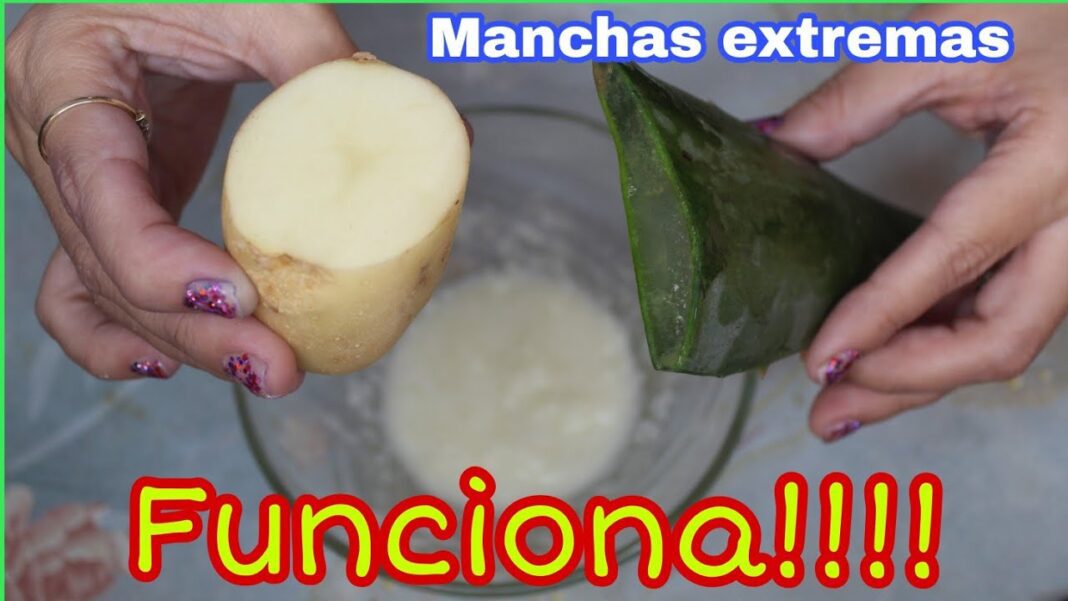 Quitar-manchas-de-la-cara-con-remedios-caseros
