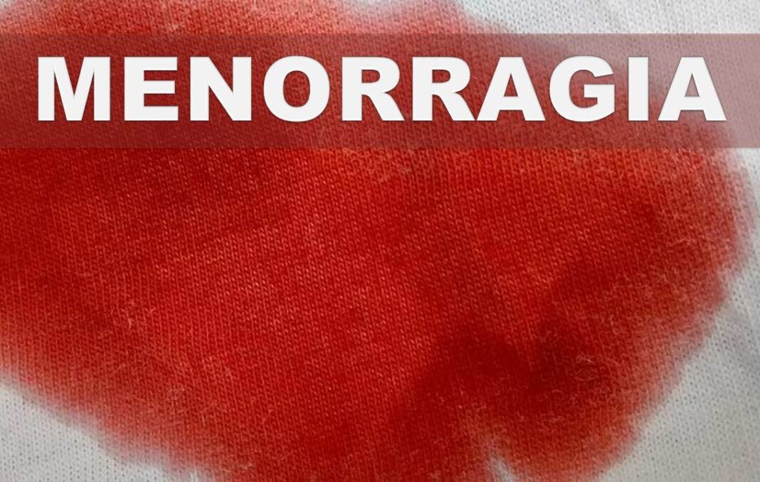 Remedio-casero-para-cortar-el-sangrado-menstrual