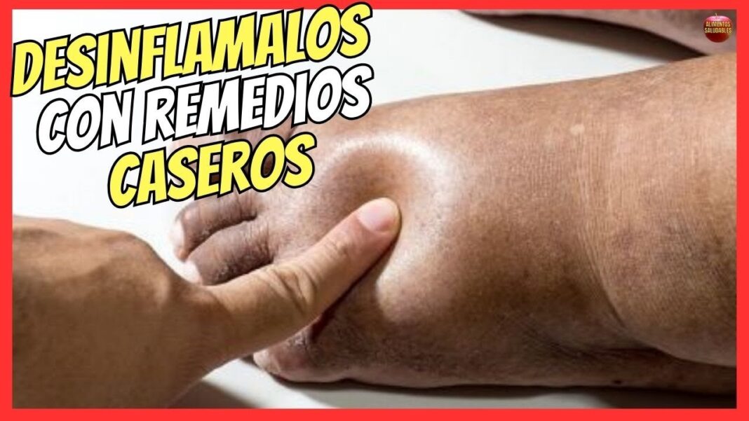 Remedio-casero-para-la-hinchazon-de-pies