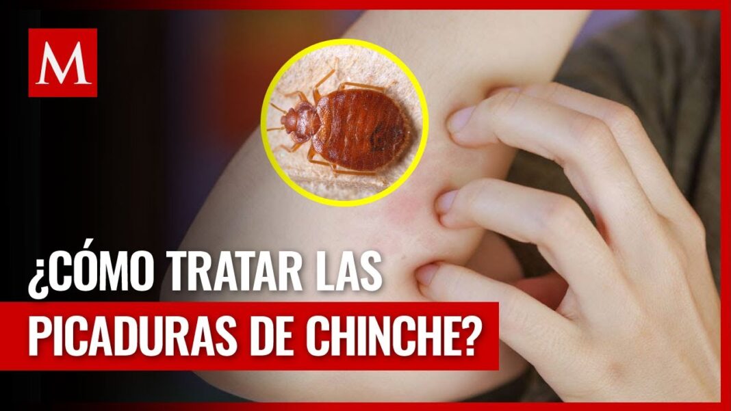 Remedio-casero-para-picadura-de-chinche