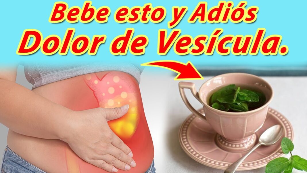 Remedio-casero-para-tratar-la-inflamacion-de-la-vesicula