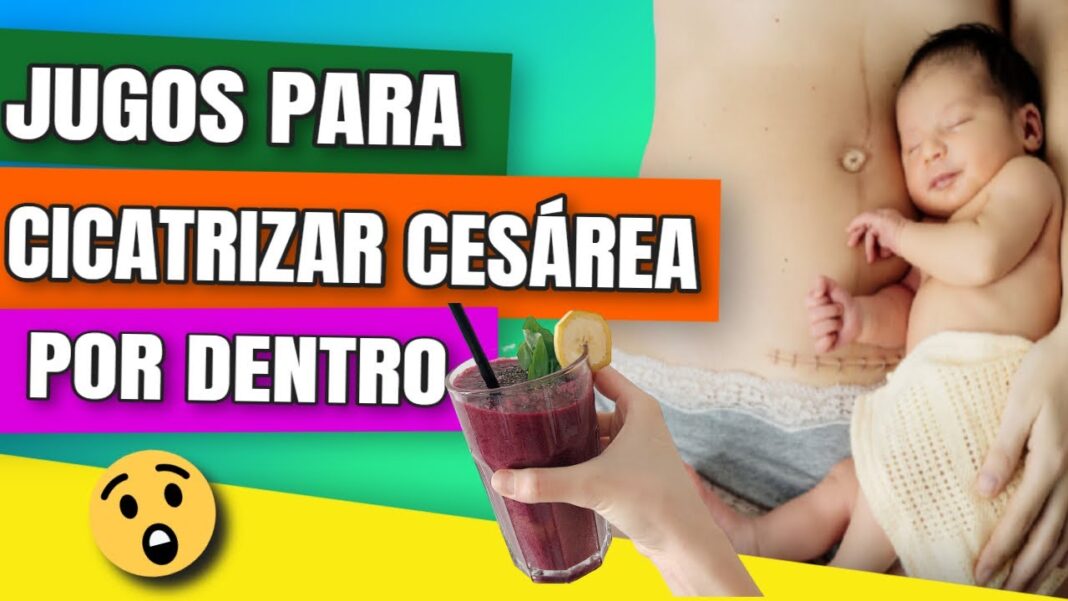 Remedios-caseros-para-cicatrizar-heridas-internas-de-operaciones