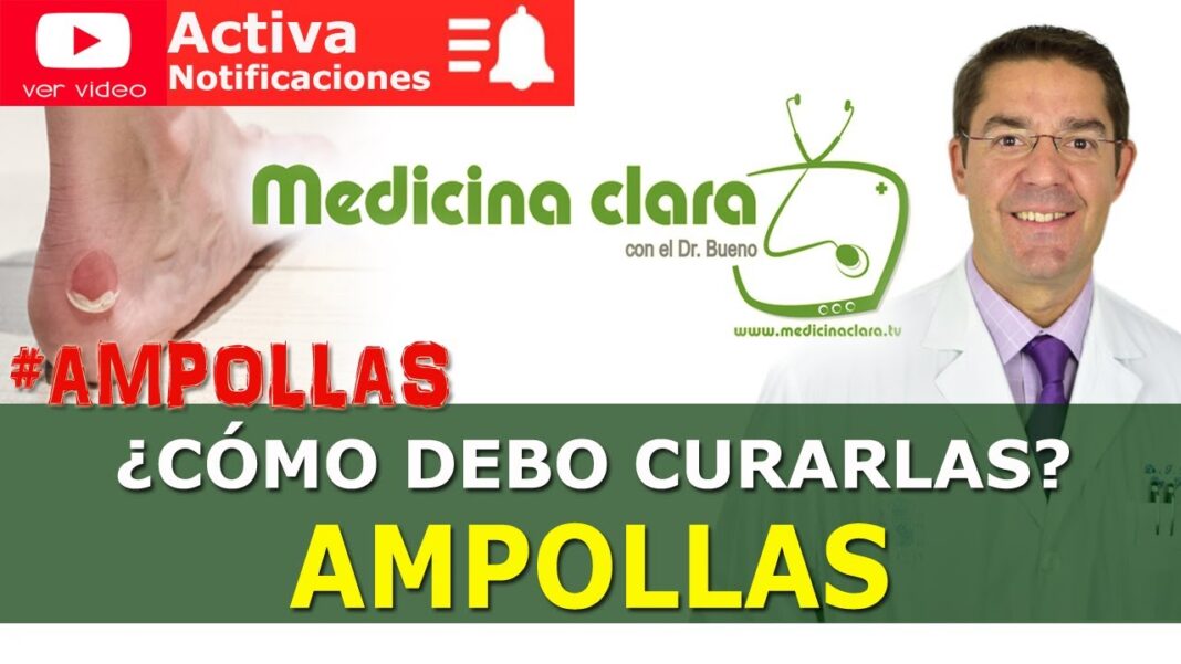 Remedios-caseros-para-curar-una-ampolla-reventada