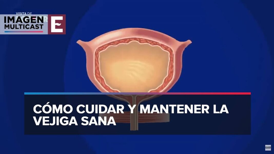 Remedios-caseros-para-desinflamar-la-vejiga