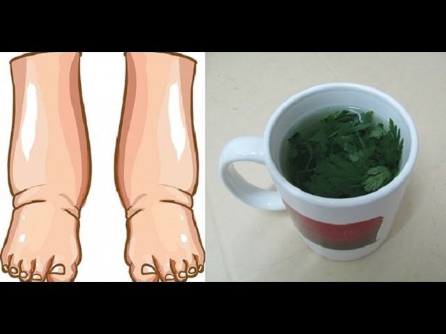 Remedios-caseros-para-desinflamar-las-piernas
