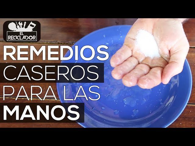 Remedios-caseros-para-el-dolor-de-manos