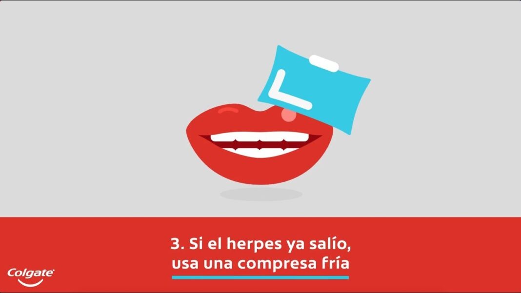 Remedios-caseros-para-el-fuego-labial