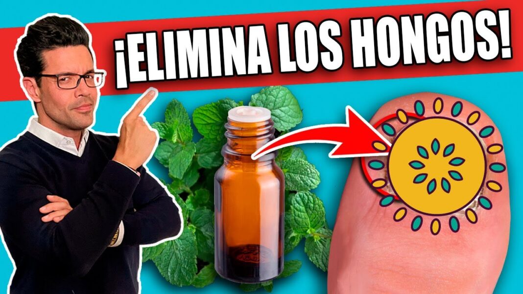 Remedios-caseros-para-el-hongo-de-las-unas-1