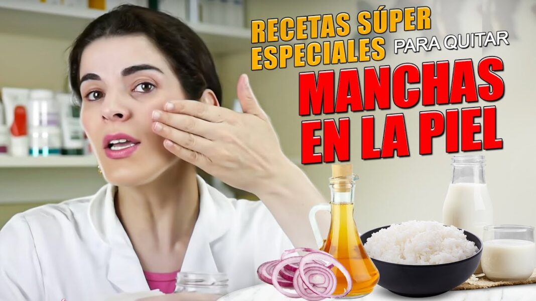 Remedios-caseros-para-el-melasma-1