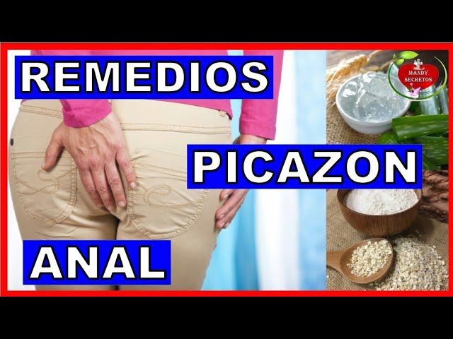 Remedios-caseros-para-la-picazon-del-ano-por-parasitos