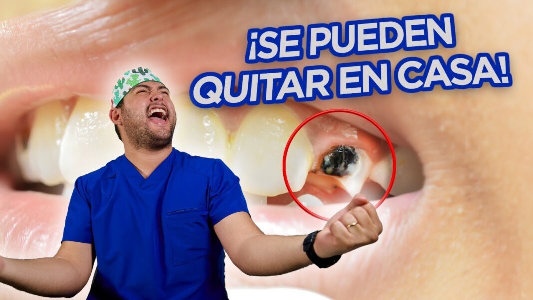 Remedios-caseros-para-las-caries