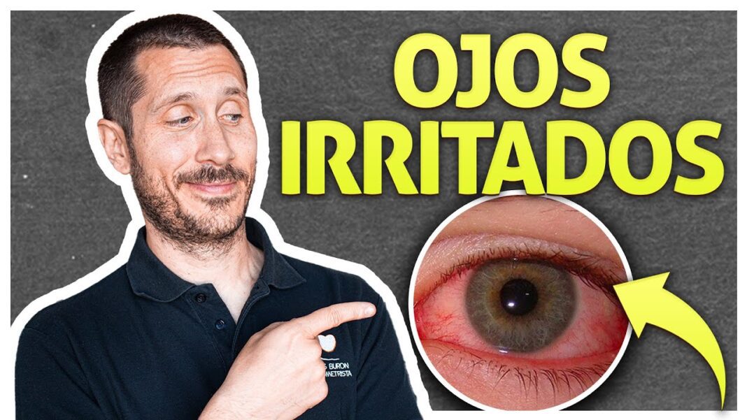Remedios-caseros-para-los-ojos