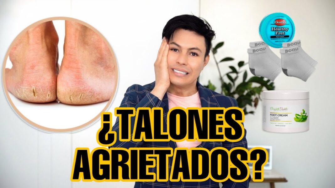 Remedios-caseros-para-talones-agrietados