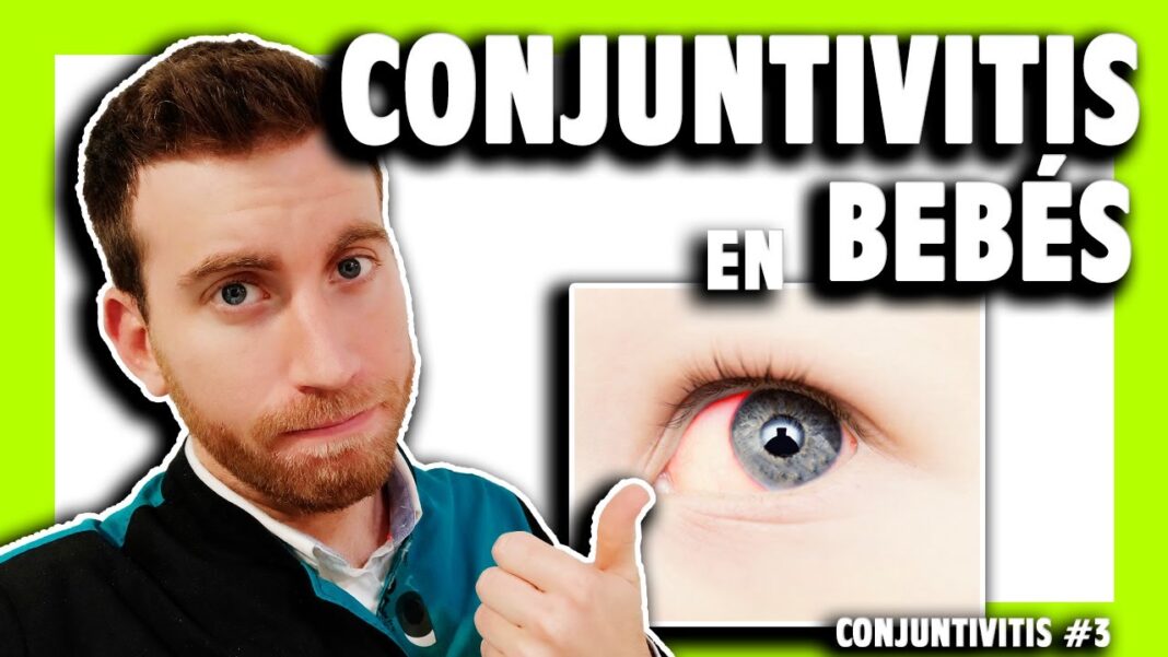 como-curar-la-conjuntivitis-en-bebes-remedios-caseros