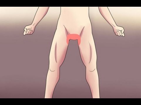 como-curar-la-tina-inguinal-con-remedios-caseros